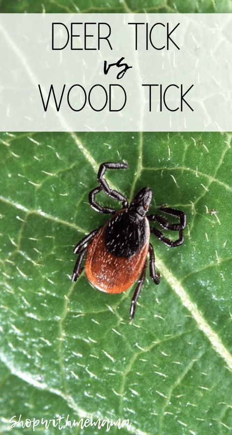 Deer Tick vs Wood Tick: What Is The Difference? #ticks #tickremoval #insects #tips #deerticks #woodticks Remove Ticks From Humans, Deer Tick Bite, Ticks On Humans, Wood Tick, Deer Ticks, Ticks On Dogs, Tick Removal, Tick Bite, American Dog