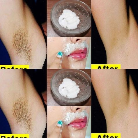 Dr. Barbara O'Neill Health Tips | Stop shaving !! This is how you should remove your pubic hair without shaving or waxing | Facebook Stop Shaving, Shaving Or Waxing, Nancy Fuller, Pubic Hair Removal, Natural Hair Removal, Hair Removal Remedies, Natural Sleep Remedies, Hair Removal Methods, How To Lighten Hair