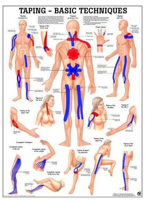 Kt Tape Volleyball, Physio Tape, Human Muscular System, Fitness Poster, Kt Tape, Volleyball Practice, Kinesio Taping, Yoga Online, Muscular System