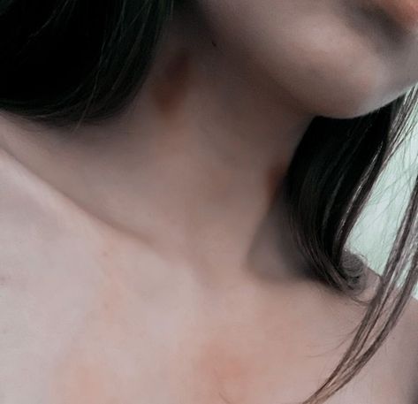 Neck Marks Aesthetic, Fake Hickies Neck, Hickies Neck Aesthetic Girl, Megan Aesthetic, Hicks On Neck, Hickies Neck Aesthetic, Hickies Neck, Image Spiderman, Lovecore Aesthetic