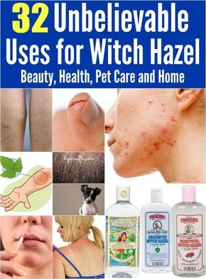 32 Little-Known Remarkable Uses For Witch Hazel. #7 Is An Absolute Life-Saver! Uses For Witch Hazel, Witch Hazel Uses, Hand Sanitizers, Body Care Products, Homemade Remedies, Witch Hazel, Pedro Pascal, Health And Beauty Tips, Natural Medicine