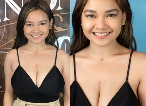 XYRIEL MANABAT GETS HER CHEST PIERCING AFTER A LONG DELAY - Where In Bacolod Xyriel Manabat, Surface Piercing Chest, Chest Piercings For Women, Chest Piercing, Surface Piercing, Thank U So Much, Photo Credit, Camisole Top, Piercings