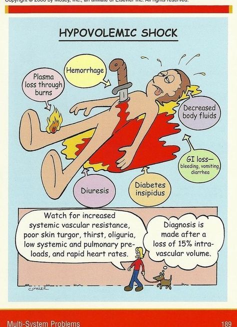 Hypovolemic Shock, Emt Study, Nursing Board, Nursing Mnemonics, Surgical Nursing, Medical Surgical Nursing, Critical Care Nursing, Nurse Rock, Nursing School Studying