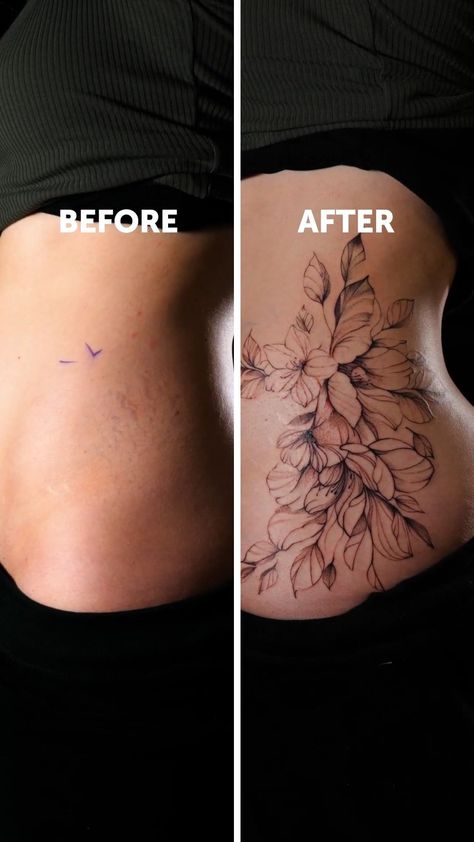 Tattoos To Cover Strech Marks, Birthmark Cover Up Tattoo, Stretch Mark Tattoo Ideas, Strech Marks Tatoos, Tattoos Over Stretch, Strechmark Cover Up Tattoo, Tattoo Stretch Mark Cover Up, Stomach Stretch Mark Tattoo, Tattoo On Strechmark