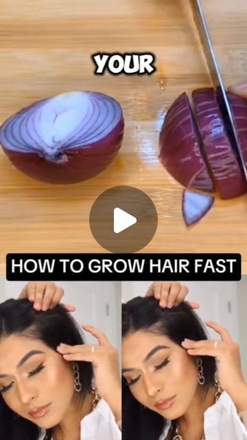 HealthTipssssss on Instagram: "HOW TO GROW HAIR FAST 
#hairgrowth #hairloss

#hairgrowthoil #naturalrecipe" How To Hair Growth Fast, Hairloss Diy Home Remedies, How To Grow Hair Fast, How To Make Your Hair Grow Faster, Grow Hair Back, How To Grow Hair Faster, How To Grow Hair, Make Hair Grow Faster, Longer Hair Faster