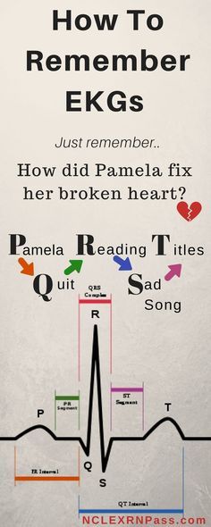 EKG interpretation made easy. If you are a nursing student looking for help with learning and understanding 12 lead ekgs and cardiac rhythms this article is for you! Cardiology is no joke in nursing school so sometimes you have to bring complicated concepts back to the basics. Simple steps to understand EKGs #ekginterpretation #nclex #nursingstudents #nursingschool EKG interpretation made easy. If you are a nursing student looking for help with learning and understanding 12 lead ekgs and cardiac Ekg Interpretation, Medical Assistant Student, Nursing Information, Nursing Mnemonics, Nursing School Survival, Cardiac Nursing, Nursing School Studying, Nursing School Tips, Nursing School Notes