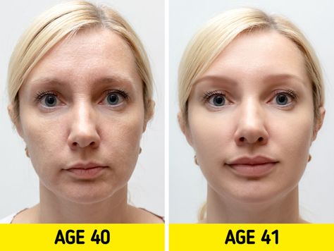 10+ Reddit Users Explain How They Would Redesign the Human Body, and They Have Some Witty Ideas Botox Training, Botox Face, Lip Wrinkles, Dermal Fillers, Vitamin C Serum, Skin Issues, Vitamin B, Skin Problems, Skin Conditions