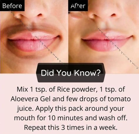 Lips Lightening, Aloe Vera Toner, Natural Aloe Vera Gel, Beginner Skin Care Routine, Skin Care Pictures, Model Skincare, Skin Care Basics, Face Skin Care Routine, Clear Skin Face