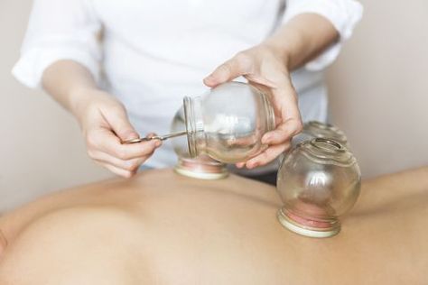 Fire cupping cups on back of female patient in Acupuncture therapy Meridian Energy, Fire Cupping, Cupping Massage, Cupping Therapy, Professional Massage, Hot Stone Massage, Hair And Beauty Salon, Full Body Massage, Deep Tissue Massage