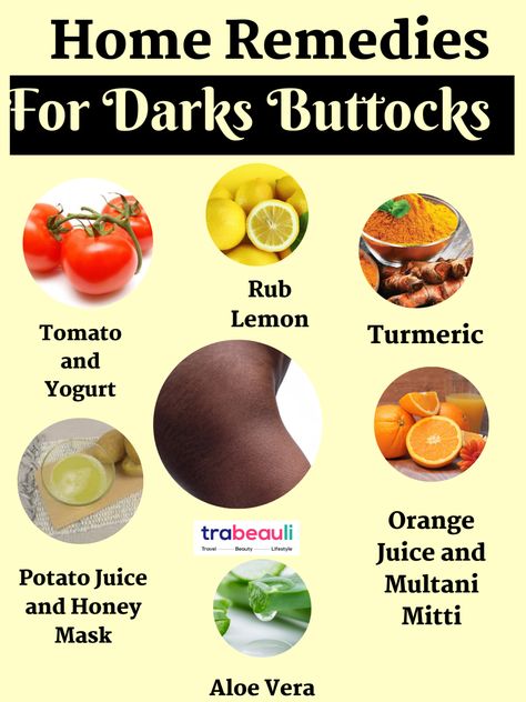 How To Get Rid Of Dark Buttocks in a Week At Home | Trabeauli Dark Spots On Buttocks, Dark Buttocks, Remedies For Dark Lips, Dark Inner Thighs, Potato Juice, Sandalwood Powder, Natural Skin Care Remedies, Dark Underarms, Lighten Dark Spots