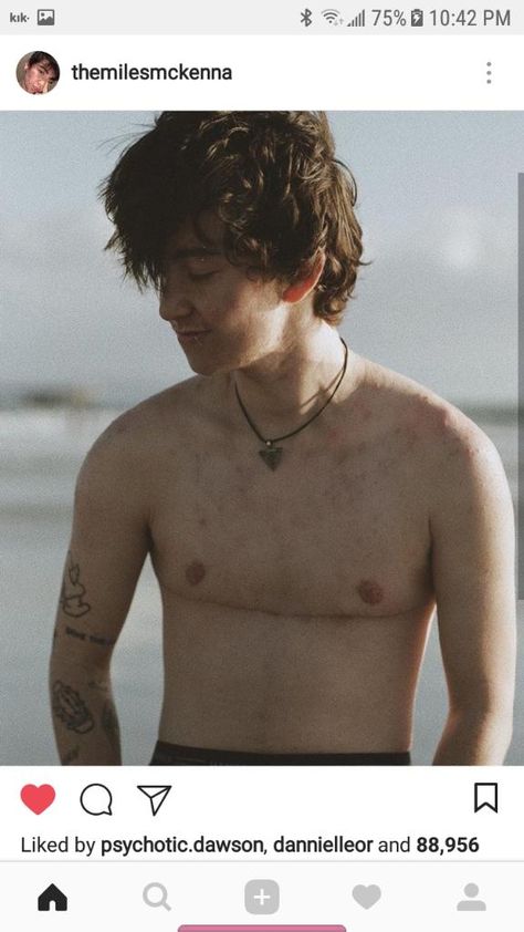 He’s daddy af Miles Mckenna Top Surgery, Nonbinary Top Surgery, Top Surgery Results, Top Surgery Ftm, Top Surgery Scars, Miles Chronicles, Acne Positivity, Miles Mckenna, Trans Masc