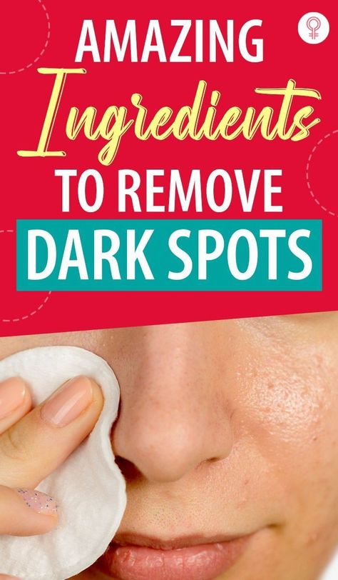 Dark Spots Remedies, Spots On Legs, Dark Spots On Face, Brown Spots Removal, Brown Spots On Face, Spots On Face, Saggy Skin, Skin Condition, Remove Dark Spots