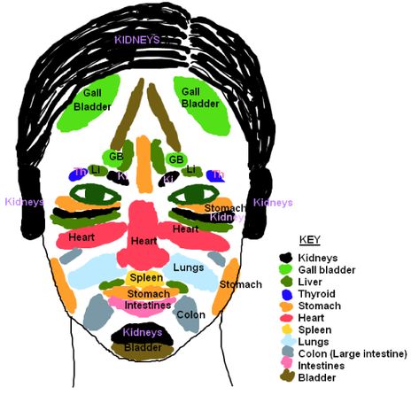 Why do we get spots/pimples at certain places on our faces? Chinese TCM answers this question with face mapping. Click to read more. Doterra Acne, Chinese Face Map, Face Mapping Acne, Body Toxins, Face Mapping, Face Reading, Face Acne, Body Organs, Qi Gong