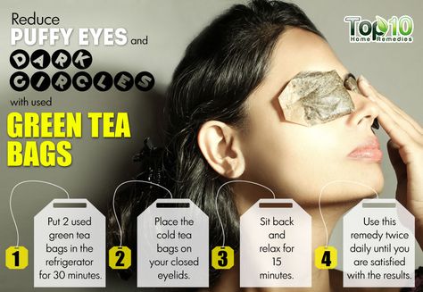 Dry Eyes Causes, Swollen Eyes, Eye Puffiness, Green Tea Bags, Under Eye Puffiness, Dark Circles Under Eyes, Eyes Problems, Under Eyes, Mascara Facial