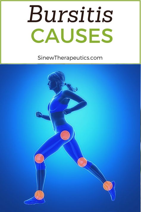 Often a cause of bursitis is from overuse or injury to the joint near the bursa. Learn more about Bursitis at SinewTherapeutics.com Bursitis Knee, Knee Pain Stretches, Knee Pain Remedy, Bursitis Hip, Joints Pain Remedy, Knee Pain Relief, Sports Injury, Nerve Pain, Shoulder Pain