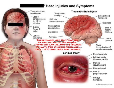 Injuries Drawing, Injury Drawing Reference, Fake Calls, Character Descriptions, Character Tropes, Anatomy References, Survival Life Hacks, Survival Life, Drawing Inspo