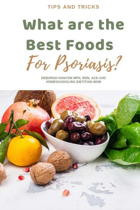 In 2017, a team of researchers from the University of California found that reduced alcohol consumption and a gluten and nightshades free diet improved symptoms of Psoriasis. Click to find out why #eczemaremedies #eczemaremediesforkids #eczematreatment #eczemadiet #psoriasisremedies #psoriasisdiet #psoriasisscalp #psoriasisremediesscalp Autoimmune Diet, Anti Oxidant Foods, Skin Diet, Alcohol Consumption, Senior Health, Inflammatory Foods, Good Foods To Eat, Foods To Avoid, University Of California