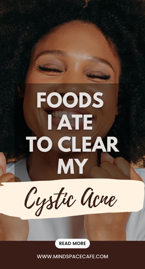 5 Foods that Cleared my Hormonal Cystic Acne for Good (Hormonal Acne Diet) - Mind Space Cafe Hormonal Acne Meal Plan, How To Get Rid Of Cystic Acne, Hormonal Cystic Acne, Cystic Acne On Chin, Jawline Acne, Hormonal Acne Diet, Treating Cystic Acne, Chin Acne, Acne Diet