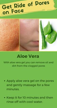 Face Open Pores Remedy, Does Aloe Vera Help Acne, How To Apply Aloe Vera To Face, Benefits Of Aloe Vera For Skin, Open Pores On Face How To Get Rid, Aleo Vera For Face, Byuti Tips, Aloevera Skincare, Open Pores On Face