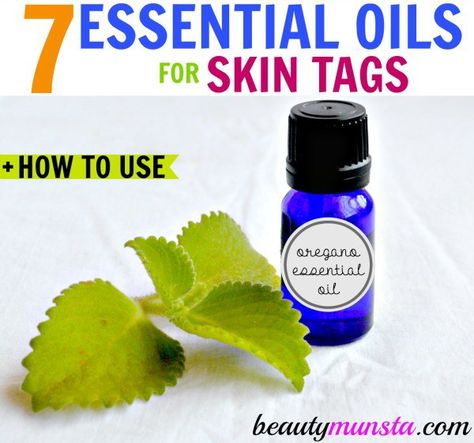 Get rid of skin tags fast - the natural way! Oils For Skin Tags, Skin Tags Essential Oils, Best Essential Oils For Skin, Essential Oil For Skin, Skin Tags On Face, Natural Beauty Hacks, Remove Skin Tags Naturally, Essential Oil Beauty, Oregano Essential Oil