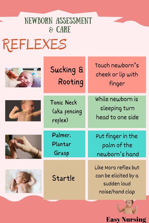 Newborn Assessment, Nclex Practice Questions, Nursing Instructor, Newborn Nursing, Nursing Information, Medical Notes, Student Midwife, Nursing Study Guide, Nursing School Motivation