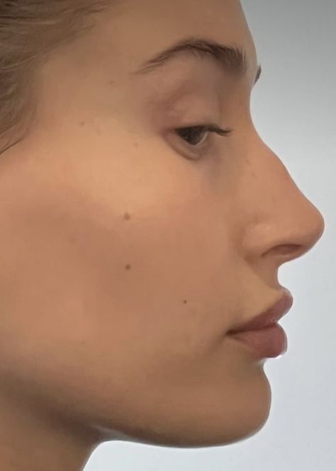 Bump Nose Side Profile, Hooked Nose Celebrities, Bump Nose Aesthetic, Nose Aesthetic Side Profile, Crooked Nose Side Profile, Bump Nose Bridge, Pointy Nose Side Profile, Bumpy Nose Side Profile, Straight Nose With Bump