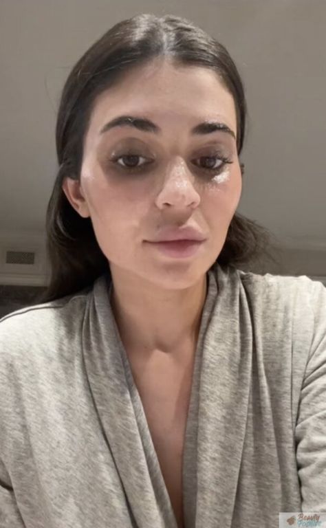 Kylie Jenner Without Makeup, Kylie Jenner No Makeup, Kylie Without Makeup, Face No Makeup, No Makeup Pictures, Kylie Jenner Face, Suntanned Skin, Migos Rapper, Shiny Black Hair