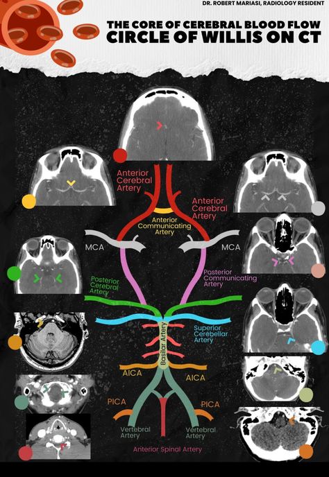 Med Notes, Medical Radiography, Radiology Student, Medicine Notes, Medical School Life, Radiology Technologist, Medicine Studies, Basic Anatomy And Physiology, Med School Motivation