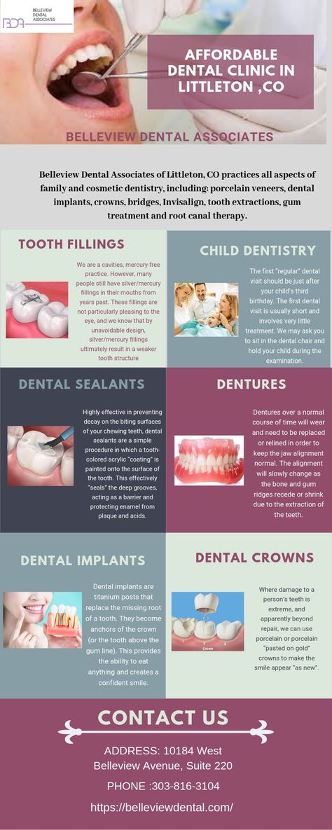 Dentistry Clinic, Teeth Extraction, Dental Sealants, Medical Items, Dental Images, Sedation Dentistry, Dental Emergency, Emergency Dentist, Tooth Extraction