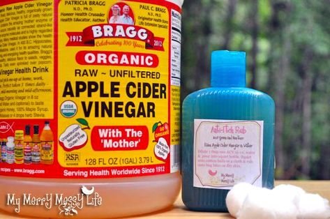 Messy Life, Anti Itch Cream, Itch Relief, Rub Recipes, Anti Itch, Baking Soda Shampoo, Bug Bites, Diy Baking, Homemade Remedies