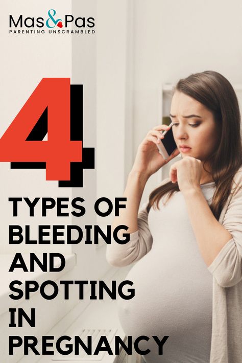 Bleeding and spotting in pregnancy can be one of the scariest things to happen to expectant mums.We’ve put a quick guide to 4 different types of pregnancy bleeds. No matter how small, always get yourself checked out if you see blood during pregnancy. #mumtobe #newmum #pregnancy 3rd Month Pregnancy, Spotting During Pregnancy, Pregnancy Spotting, 4 Weeks Pregnant, 9 Weeks Pregnant, 11 Weeks Pregnant, 6 Weeks Pregnant, 5 Weeks Pregnant, Fertility Doctor