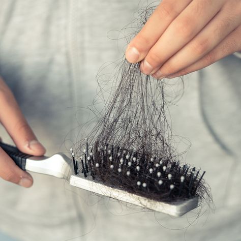 Doctors Share 4 'Irritating Hair Care Ingredients' Often Responsible for Severe Hair Loss, Thinning, and Shedding Drinks For Hair Growth, Losing Hair, Help Hair Growth, Healthy Natural Hair Growth, Hair Specialist, Promote Healthy Hair Growth, Lost Hair, Celebrity Hair Stylist, Scalp Health