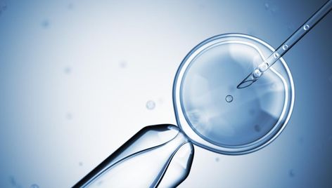 Artificial insemination: Uses, procedure, and risks Mucinex For Fertility, Low Sperm Count, Hcg Levels, Artificial Insemination, Ivf Procedure, Sperm Count, Ivf Implantation, Ivf Clinic, Ivf Cost