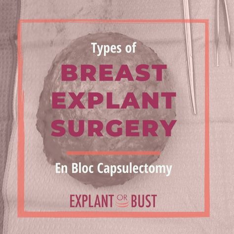 Explant Surgery Recovery, Breast Explant Before And After, Explant Surgery Before And After, Explant Surgery, Mastectomy Recovery, Increase Breast Size, Breast Lift Surgery, Breast Implant Illness, Types Of Surgery