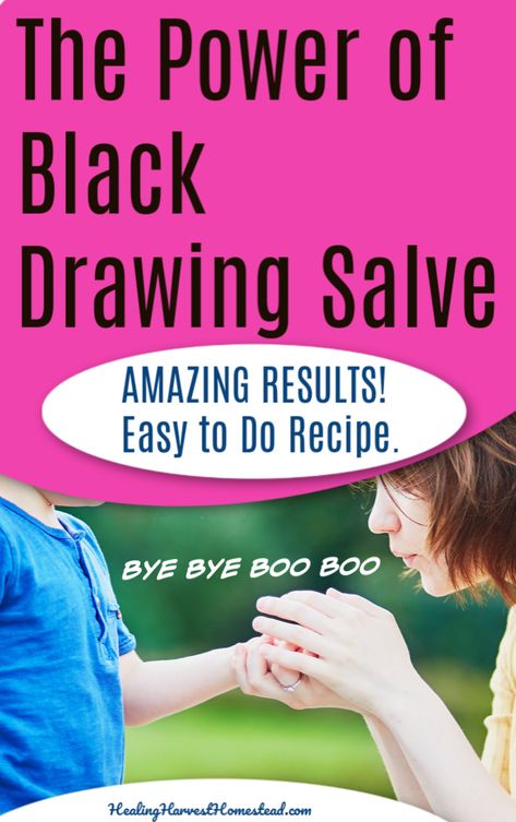 An easy homemade  black charcoal drawing salve recipe that really works! #healingharvesthomestead #homemade #diy #charcoal # stings # bites # homeremedies Drawing Salve Recipe, Black Drawing Salve, Diy Charcoal, Drawing Salve, Medical Jokes, Medical Mnemonics, Medical Brochure, Natural Remedies For Migraines, Salve Recipes