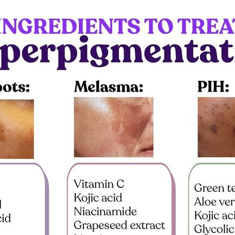 Clinikally on Instagram: "👆The cheat sheet to hyperpigmentation from our dermatologists ✨  SAVE THIS BEFORE IT DISAPPEARS 📥  𝐰𝐰𝐰.𝐜𝐥𝐢𝐧𝐢𝐤𝐚𝐥𝐥𝐲.𝐜𝐨𝐦  . . .  #HyperpigmentationTreatment #HyperpigmentationSolution #skincare #SkincareProductsThatWork #ProductRecommendation #SkincareforAll #SkincareGoals #SkincareTips #MedicalSkincare #SkinExperts #SkincareIndia #KojicAcidCream #KojicAcidSkincare #SkincareDaily #SkincareOnline #SkincareEssentials #BudgetSkincare #PharmacyProducts #VitaminCSkincare #DermatologistSkincare #BrighteningSkincare #SalicylicAcid #Hyperpigmentation #melasmatreatment" Skincare Cheat Sheet, Skin Care Cheat Sheet, Skincare For Hyperpigmentation, Hydrating Face Mask Diy, Skincare Budget, Dry Skin Diy, Skin Care Hyperpigmentation, Dermatologist Skin Care, The Cheat Sheet