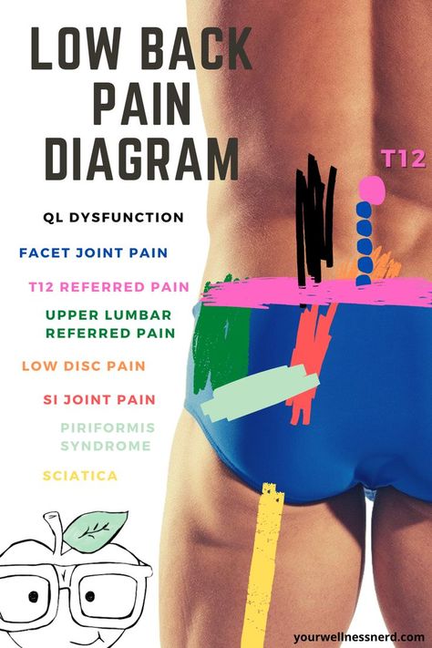 low back pain diagram Low Back Pain Relief, Referred Pain, Nasm Cpt, Middle Back Pain, Piriformis Syndrome, Posture Exercises, Lip Care Routine, Medical Anatomy, Nerve Damage