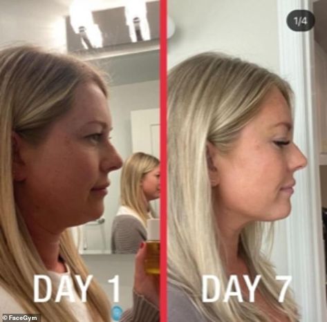 Before and after: Women reveal how at-home facial massage tools are banishing their jowls and softening lines Facial Massage Before And After, Face Massage Before And After, Face Cupping Before And After, Facial Balancing Before And After, Facial Cupping Before And After, Facial Before And After, Facial Cupping, Facial Massage Tool, Instant Lifts