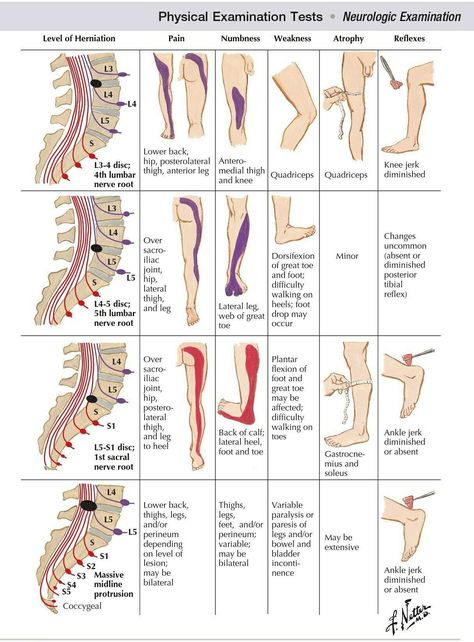 Nerve Anatomy, Physical Therapy School, Physical Therapy Assistant, Bolesti Chrbta, Basic Anatomy And Physiology, Physical Therapy Exercises, Human Body Anatomy, Spine Health, Muscle Anatomy