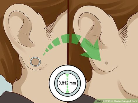 How to Close Gauged Ears: 11 Steps (with Pictures) - wikiHow Ear Guages, Gauged Ears, Small Gauges, Stretched Ears, Ear Gauges, Starting A New Job, New Job, Cleaning Clothes, Ear Piercings