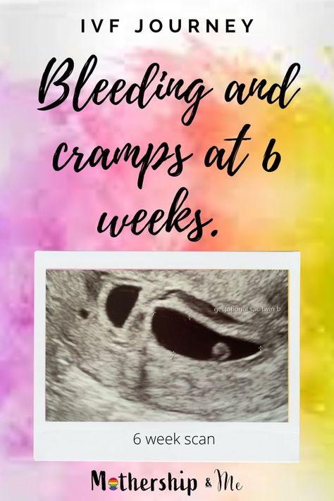 bleeding blood clot and cramps at 6 weeks pregnant. our ivf journey. Pregnant 6 Weeks, Five Weeks Pregnant, Seven Weeks Pregnant, 7 Weeks Pregnant, 6 Weeks Pregnant, 5 Weeks Pregnant, Hcg Levels, Vegan Pregnancy, Ivf Pregnancy