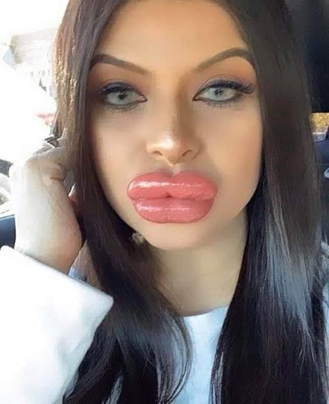 Big Lips Natural, Funny Lips, Botox Lips, Fake Lips, Facial Surgery, Botox Fillers, Juicy Lips, Lip Fillers, Permed Hairstyles