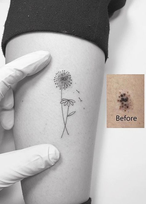 #tattoos #tattooideas #dandelion #dandeliontattoo Tattoo Mole Cover Up, Mole Cover Up Tattoo Ideas, Tattoos To Cover Moles, Tattoo Around Mole, Mole Tattoo Ideas, Mole Cover Up Tattoo, Small Cover Up Tattoos For Women, Butterfree Tattoo, Small Tattoo Cover Up Ideas