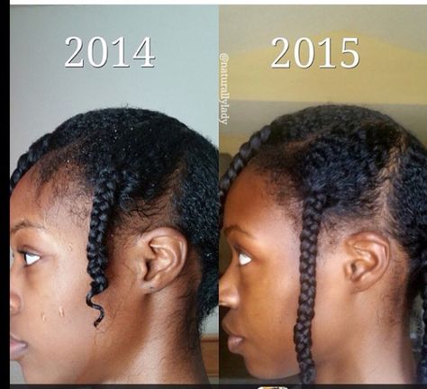 Growth Grow Natural Hair, Hair Growth Journey, Extreme Hair Growth, Natural Hair Growth Tips, Hair Growth Secrets, Hair Care Growth, Fast Hair, How To Grow Natural Hair, Extreme Hair