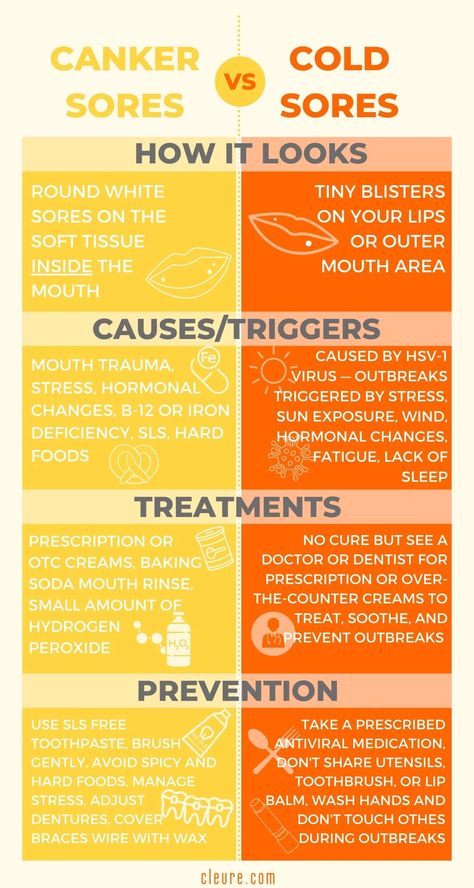 Canker Sores vs Cold Sores Infographic – Cleure Types Of Mouth, Canker Sore Causes, Ulcer Remedies Mouth, Canker Sore Remedy, Mouth Rinse, Sick Remedies, Cold Sores, Cardiac Nursing, Canker Sore