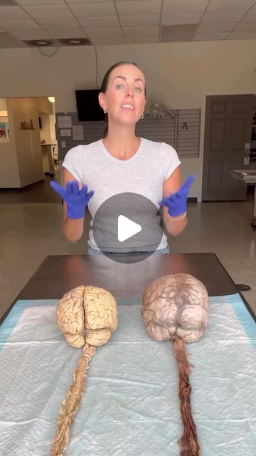 Dr. Goris Nazari PhD on Instagram: "The Human Nervous System.  - - - Video by @mrs.b.tv  - - - #brain #nervoussystem #science #facts" Real Brain Pictures, Neuron Connections, Human Brain Facts, Real Brain, Human Body System, Human Brain Anatomy, Human Circulatory System, Brain Nervous System, Human Nervous System