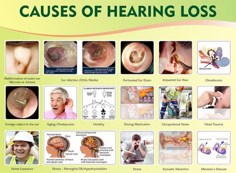 Hearing aid: WHAT ARE THE SYMPTOMS OF HEARING LOSS? Hearing Loss Awareness, Audiologist Office, Impacted Ear Wax, Ear Pressure, Speech And Hearing, Language Delay, Clinic Interior, Teacher Board, Deaf Culture