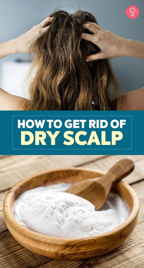 How To Help Dry Scalp, Dry Patches On Scalp, How To Treat Dry Scalp, How To Get Rid Of Dry Scalp, Get Rid Of Dry Scalp, Extremely Dry Scalp, Dry Scalp Shampoo, Itchy Scalp Remedy, Dry Scalp Remedy