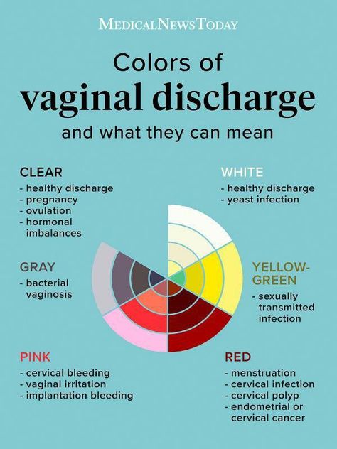 Feminine Health, Color Guide, Medical News, Medical Knowledge, Healthy Pregnancy, Health Facts, Body Health, Womens Health, Fertility