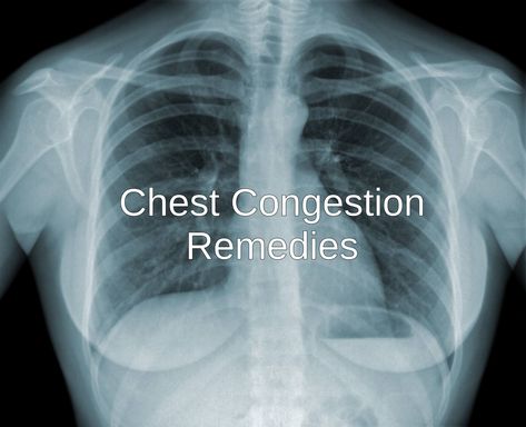 10 Home Remedies for Chest Congestion - Chest congestion is usually associated with some respiratory infection. we discuss some home remedy Chest Infection Remedies, Chest Cold Remedies, Respiratory Infection Remedies, Home Remedies For Congestion, Natural Expectorant, Remedies For Chest Congestion, Chest Congestion Remedies, Congestion Remedies, Chest Cold